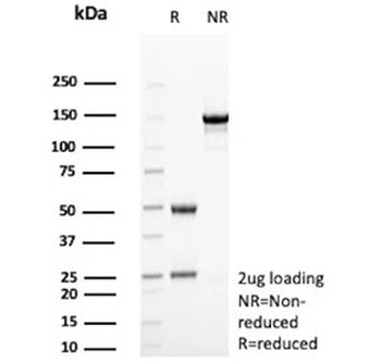 ARK1C1 Antibody / Aldo-keto Reductase Family 1 Member C1