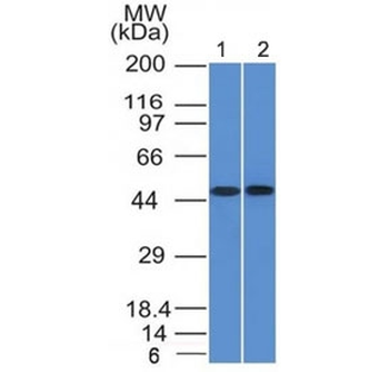 FLI1 Antibody / Friend leukemia integration 1 transcription factor