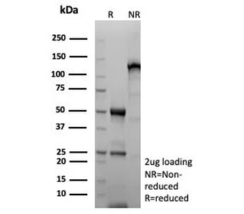 MDM2 Antibody