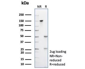 PRAME Antibody / OIP-4