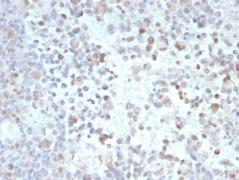 PRAME Antibody / OIP-4