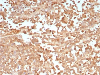 PRAME Antibody / OIP-4