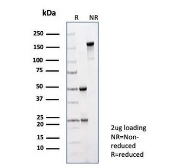 PRAME Antibody / OIP-4