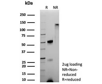 Recombinant Hemoglobin alpha Antibody / HBA