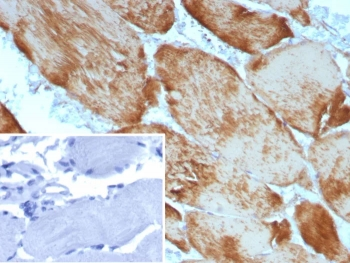 Recombinant Alpha Actin 1 Antibody / ACTA1