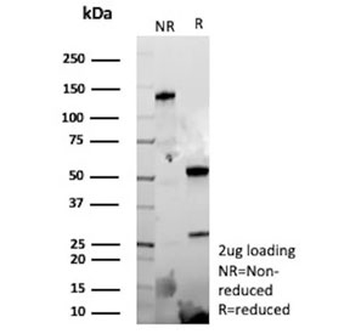 EPHB4 Antibody / EPH Receptor B4