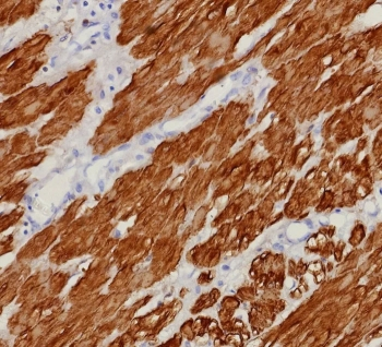 Calponin 1 Antibody