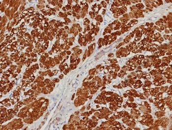 Calponin 1 Antibody
