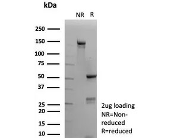 Calponin 1 Antibody