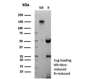 NKX2.1 Antibody / TTF-1