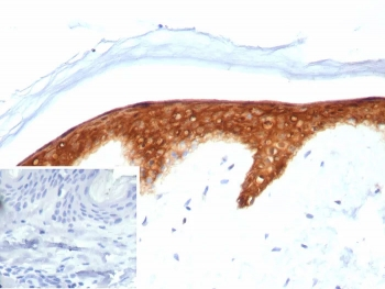 SERPINB5 Antibody / MASPIN