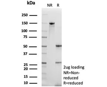 SERPINB5 Antibody / MASPIN