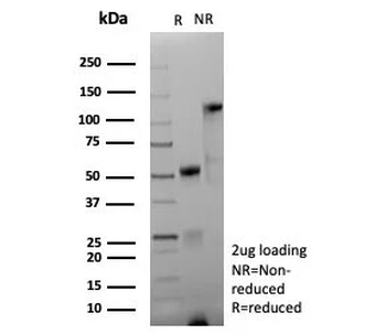 L1CAM Antibody / NCAM-L1 / CD171