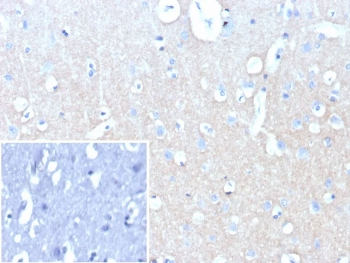 L1CAM Antibody / NCAM-L1 / CD171
