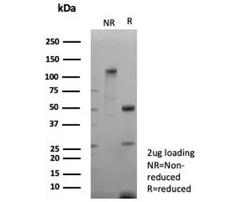 L1CAM Antibody / NCAM-L1 / CD171
