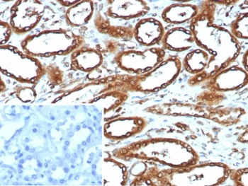 Recombinant Calnexin Antibody
