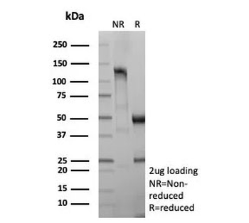 IL3RA Antibody / CD123