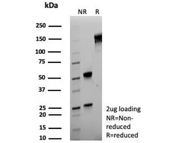 S100A4 Antibody / FSP1