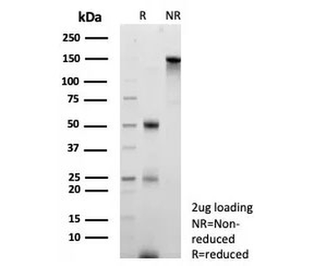 S100A4 Antibody / FSP1