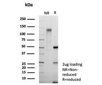 Recombinant Phospho-RNA Polymerase II CTD Repeat YSPTSPS Antibody / pS5