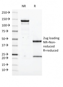 Transglutaminase 2 Antibody