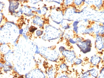 Transglutaminase 2 Antibody