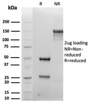 Recombinant SDC1 Antibody / Syndecan-1 / CD138