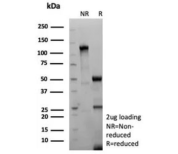Recombinant TSHR beta Antibody / Thyroid Stimulating Hormone Receptor beta