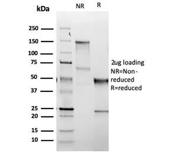 Thyroid Stimulating Hormone Receptor / TSHR Antibody (beta chain)