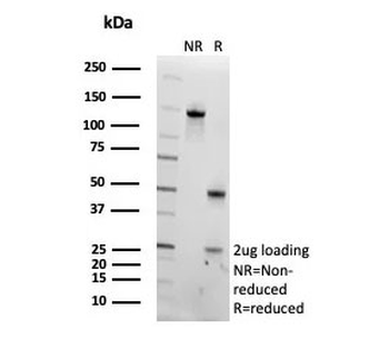 PNLIP Antibody / Pancreatic lipase