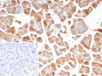 PNLIP Antibody / Pancreatic lipase