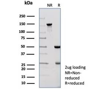 PNLIP Antibody / Pancreatic lipase