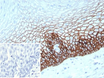 Recombinant CD44v6 Antibody