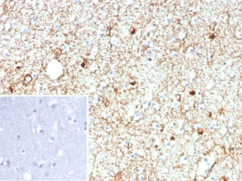GFAP Antibody / Glial Fibrillary Acidic Protein