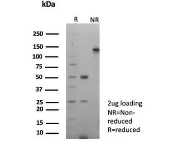 GFAP Antibody / Glial Fibrillary Acidic Protein
