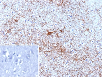 GFAP Antibody / Glial Fibrillary Acidic Protein