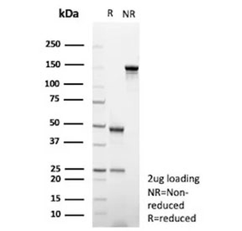 GFAP Antibody / Glial Fibrillary Acidic Protein