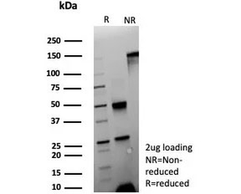 CEACAM1 Antibody / BGP-1