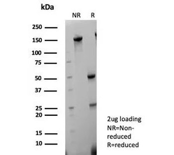 CK5/6 Antibody / Cytokeratin 5/6