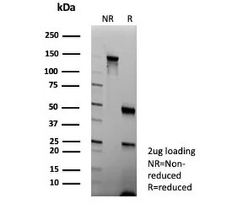 KRT5/6 Antibody / Cytokeratin 5/6