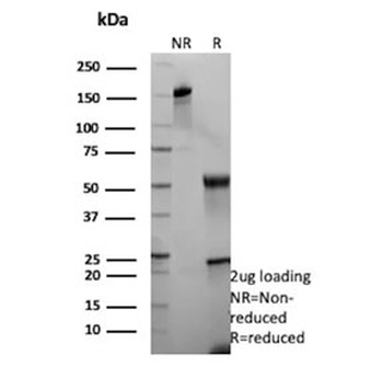 Cytokeratin 13 Antibody / KRT13