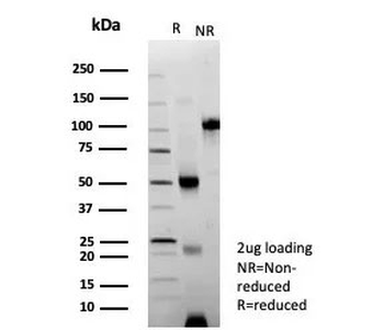 NCAM / CD56 Antibody