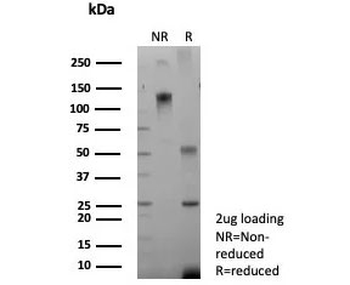 CFTR Antibody / Cystic Fibrosis Transmembrane Regulator