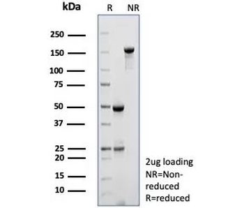 MYH7 Antibody / Myosin 7