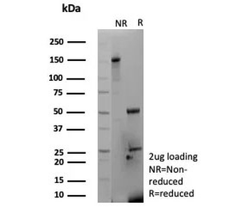 MYH7 Antibody / Myosin 7