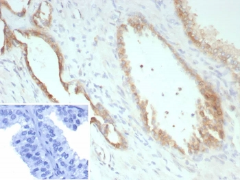 Pan-Cadherin Antibody