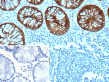 E-Cadherin Antibody / CDH1