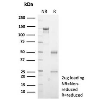 E-Cadherin Antibody / CDH1