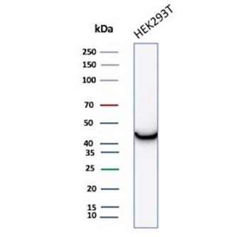 CKB Antibody / Creatine kinase B / Creatine Phosphokinase-BB
