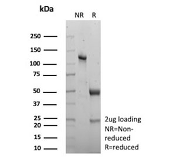 CKB Antibody / Creatine kinase B / Creatine Phosphokinase-BB
